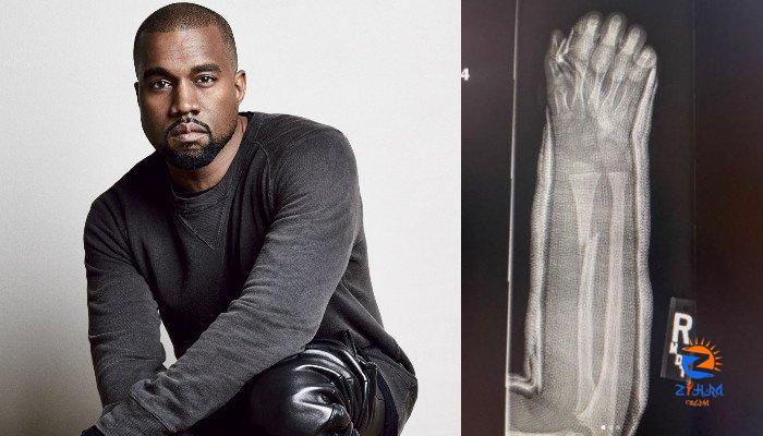 Kanye West shares x rays snaps of son Saints broken arm