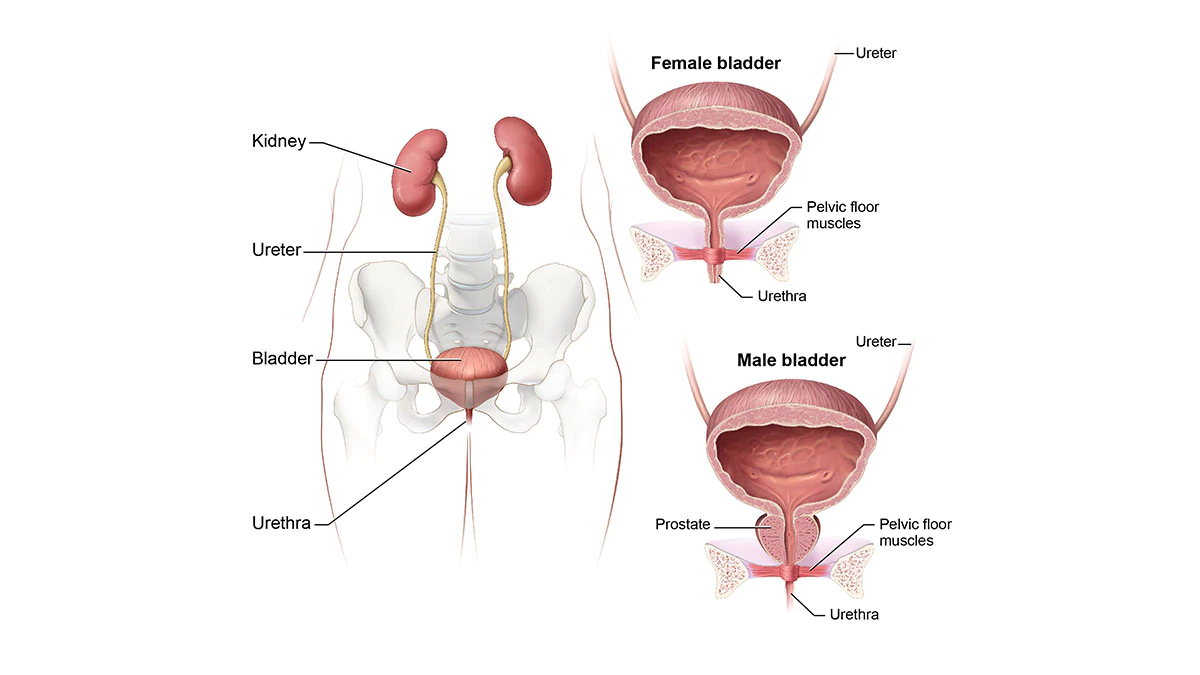 Definition & Facts of Interstitial Cystitis