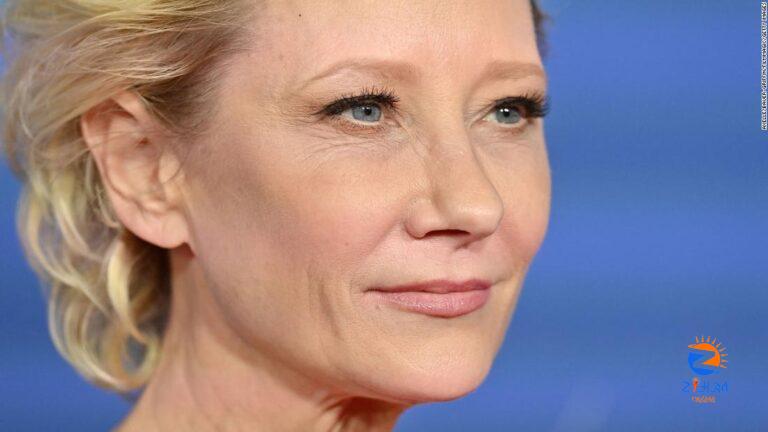 Anne Heche remains in critical condition as police continue to investigate her car crash