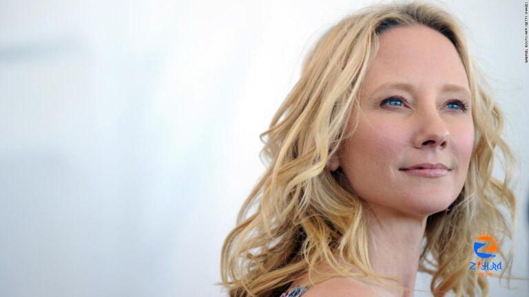 Anne Heche, ‘Wag the Dog’ and ‘Donnie Brasco’ star, has died at 53