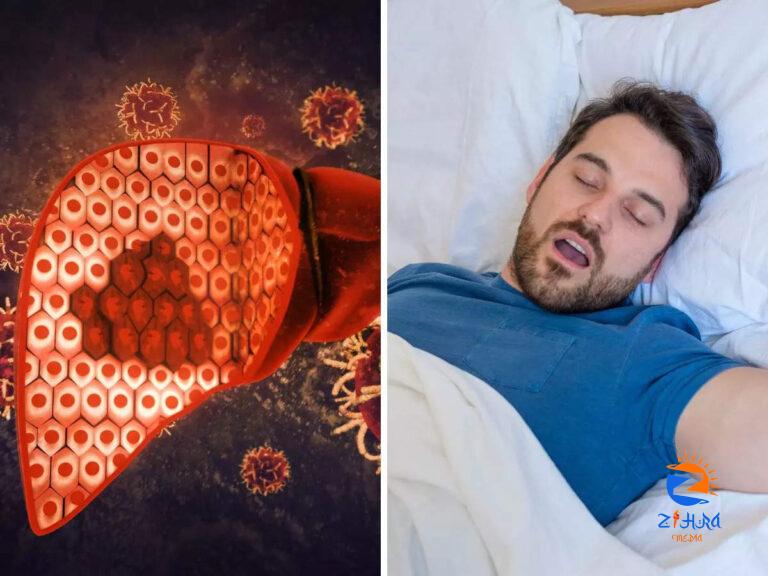 Fatty liver disease: Your sleeping habits can determine your risk of the disease