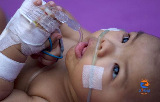 RSV in Infants and Young Children