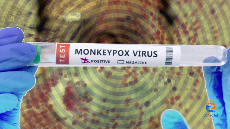 Does monkeypox need a new name?