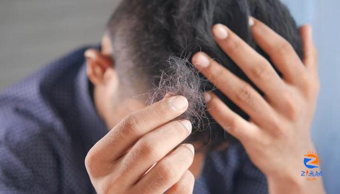 Men, you might be losing hair because of sugary drinks