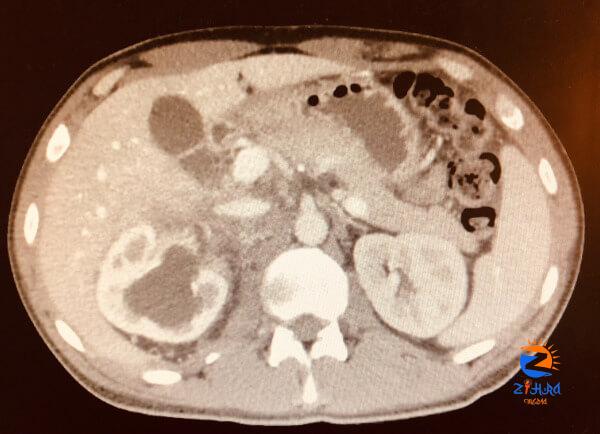 Clinical Challenge: Vomiting and Testicle Pain