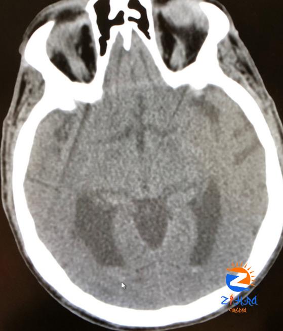 Clinical Challenge: Altered Mental Status