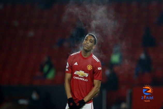 Anthony Martial ruled out of Manchester United’s FA Cup final clash