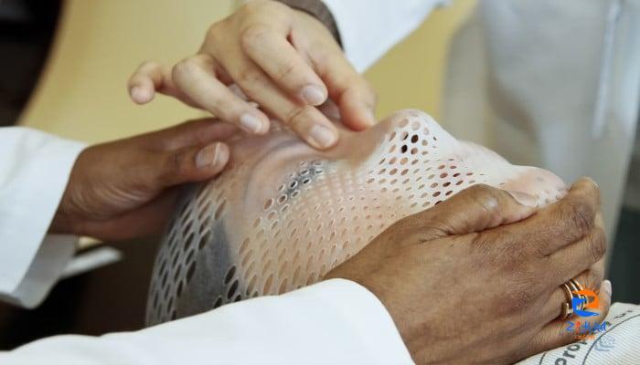 ‘New wound dressings could help burn injuries heal faster’