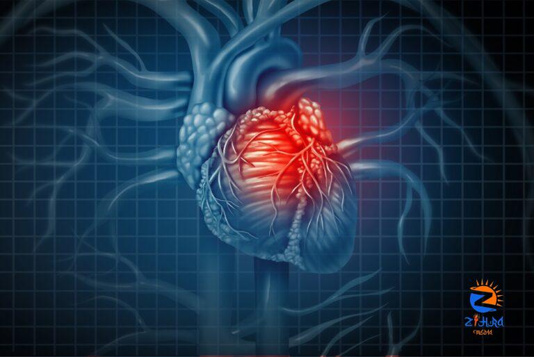 Case Study: Cardiovascular Complications of Chronic Obstructive Pulmonary Disease