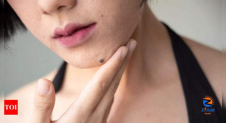 Astrological meaning of moles on the chin