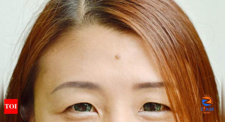 Astrological significance of moles on the forehead