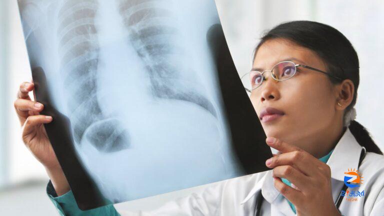 About Active Tuberculosis Disease | Tuberculosis (TB)