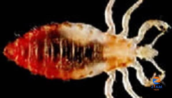 About Body Lice | Lice