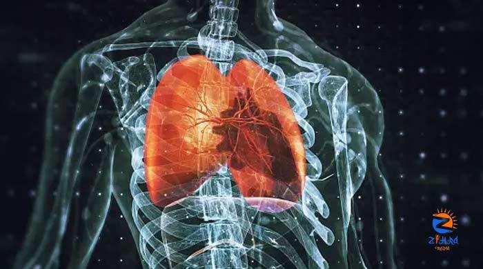 Lung cancer slowed in 60% patients in new drug trial